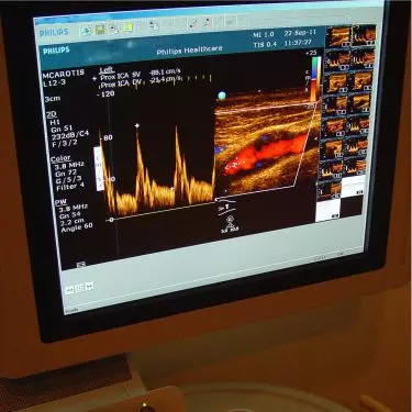 2D Echo test in Gurgaon india